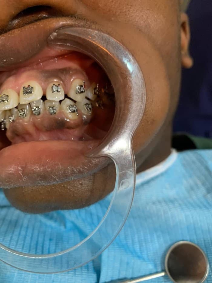 Patient smile